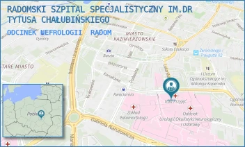 ODCINEK NEFROLOGII - RADOMSKI SZPITAL SPECJALISTYCZNY IM. DR TYTUSA CHAŁUBIŃSKIEGO - TOCHTERMANA 1,  RADOM
